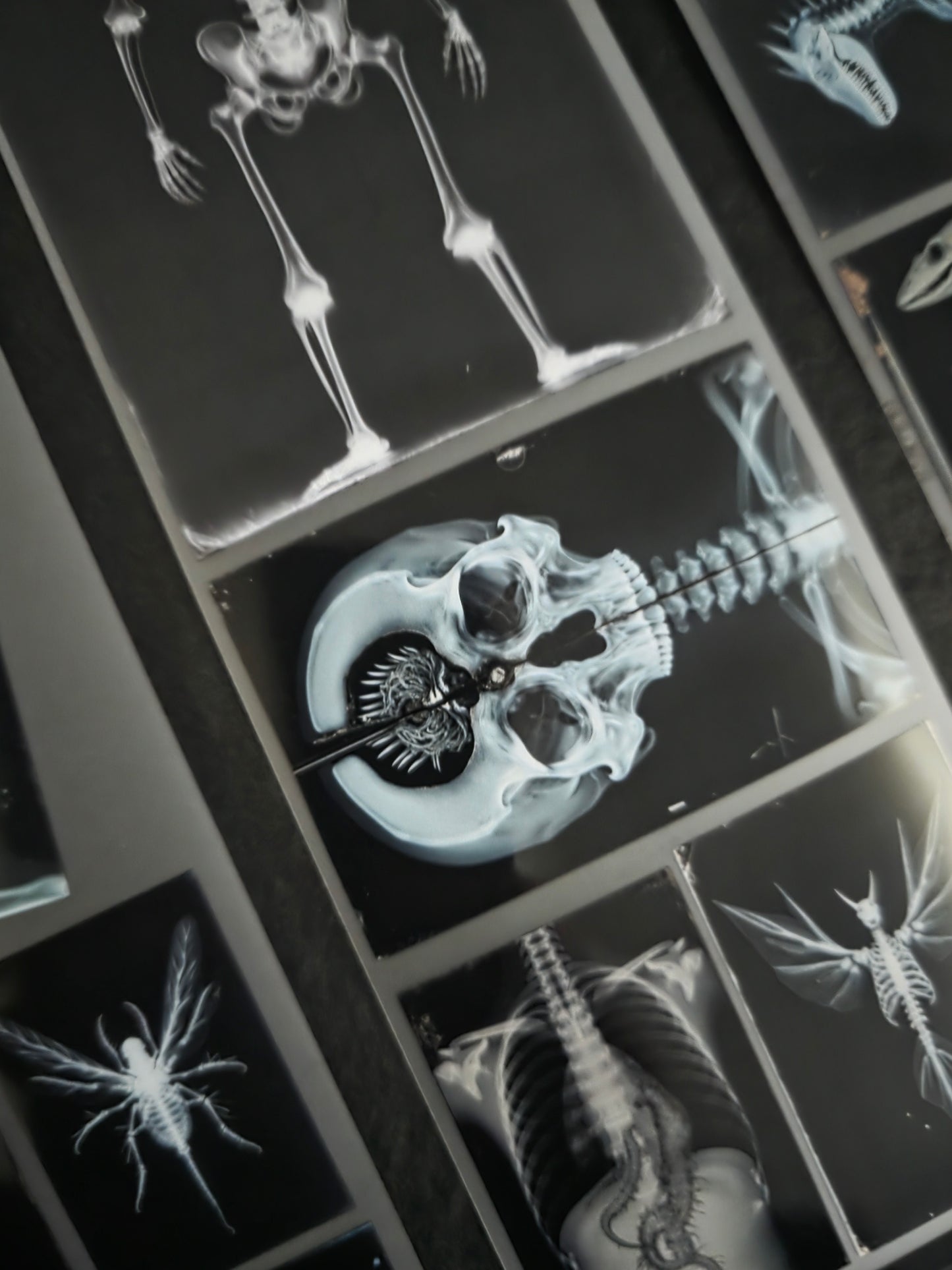 XRays 7cm