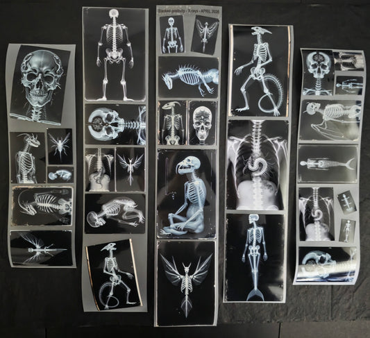 XRays 7cm