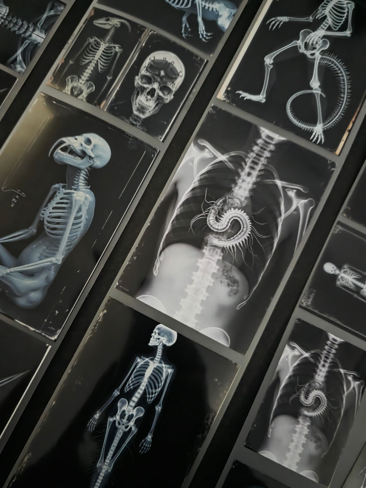 XRays 7cm